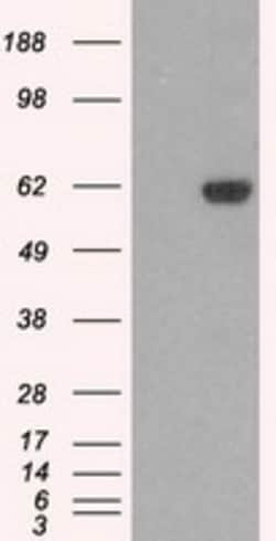 OriGene STK39 Mouse Monoclonal Antibody [Clone ID: OTI2E10], Quantity:
