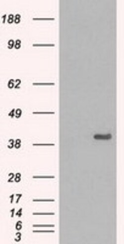 OriGene ERK2 (MAPK1) Mouse Monoclonal Antibody [Clone ID: OTI7E7], Quantity: