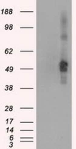 OriGene CD4 Mouse Monoclonal Antibody [Clone ID: OTI3B4], Quantity: Each
