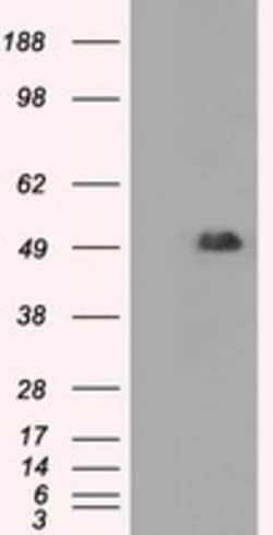 OriGene CD4 Mouse Monoclonal Antibody [Clone ID: OTI6E10], Quantity: Each