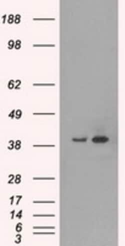 OriGene ERK2 (MAPK1) Mouse Monoclonal Antibody [Clone ID: OTI9H1], Quantity: