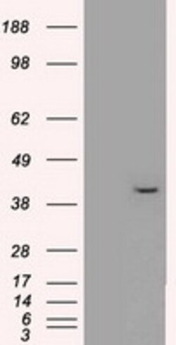 OriGene ERK2 (MAPK1) Mouse Monoclonal Antibody [Clone ID: OTI1C11], Quantity: