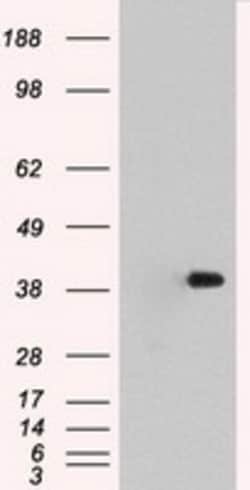 OriGene ERK2 (MAPK1) Mouse Monoclonal Antibody [Clone ID: OTI1D3], Quantity:
