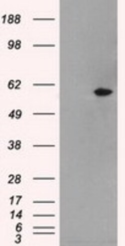 OriGene MADM (NRBP1) Mouse Monoclonal Antibody [Clone ID: OTI2C8], Quantity: