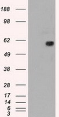 OriGene MADM (NRBP1) Mouse Monoclonal Antibody [Clone ID: OTI7E2], Quantity: