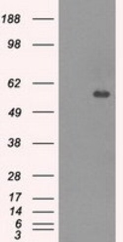 OriGene CNDP1 Mouse Monoclonal Antibody [Clone ID: OTI2F8], Quantity: Each