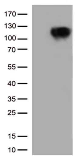 OriGene B Raf (BRAF) Mouse Monoclonal Antibody [Clone ID: OTI3B12], Quantity: