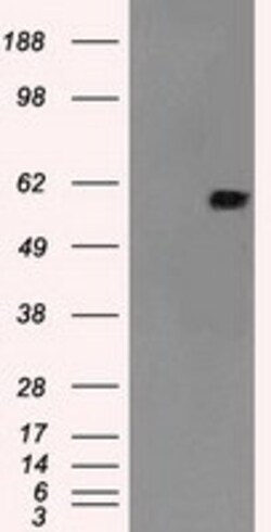 OriGene MADM (NRBP1) Mouse Monoclonal Antibody [Clone ID: OTI6C11], Quantity: