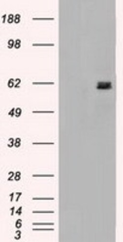 OriGene MADM (NRBP1) Mouse Monoclonal Antibody [Clone ID: OTI7C5], Quantity:
