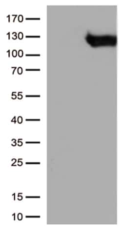 OriGene B Raf (BRAF) Mouse Monoclonal Antibody [Clone ID: OTI3E8], Quantity: