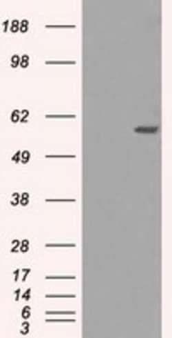 OriGene MADM (NRBP1) Mouse Monoclonal Antibody [Clone ID: OTI5C3], Quantity: