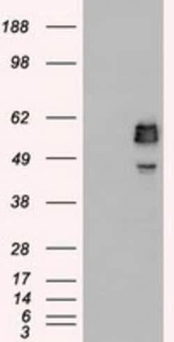 OriGene SSB Mouse Monoclonal Antibody [Clone ID: OTI3F11], Quantity: Each