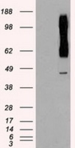 OriGene Rad9 (RAD9A) Mouse Monoclonal Antibody [Clone ID: OTI7B11], Quantity: