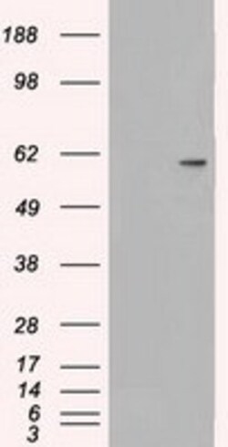 OriGene MADM (NRBP1) Mouse Monoclonal Antibody [Clone ID: OTI2H1], Quantity: