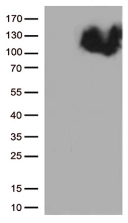 OriGene B Raf (BRAF) Mouse Monoclonal Antibody [Clone ID: OTI4A5], Quantity: