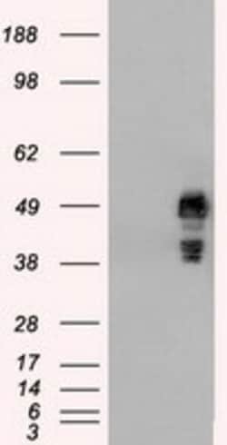 OriGene SSB Mouse Monoclonal Antibody [Clone ID: OTI6G7], Quantity: Each