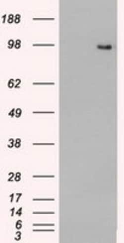 OriGene TYRO3 Mouse Monoclonal Antibody [Clone ID: OTI2G2], Quantity: Each