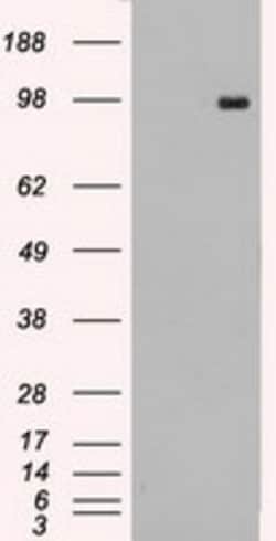 OriGene TYRO3 Mouse Monoclonal Antibody [Clone ID: OTI2D11], Quantity: