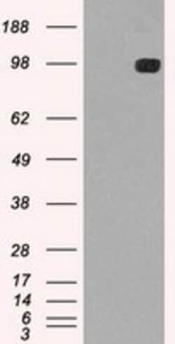 OriGene TYRO3 Mouse Monoclonal Antibody [Clone ID: OTI5B4], Quantity: Each