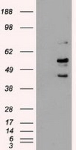 OriGene STK3 Mouse Monoclonal Antibody [Clone ID: OTI2D4], Quantity: Each