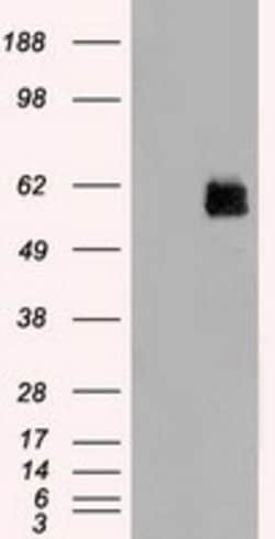 OriGene STK3 Mouse Monoclonal Antibody [Clone ID: OTI4G10], Quantity: Each