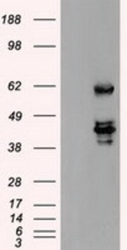 OriGene SSB Mouse Monoclonal Antibody [Clone ID: OTI1E11], Quantity: Each