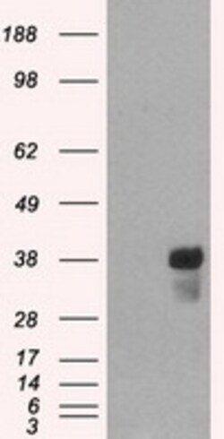 OriGene CD2 Mouse Monoclonal Antibody [Clone ID: OTI4E4], Quantity: Each