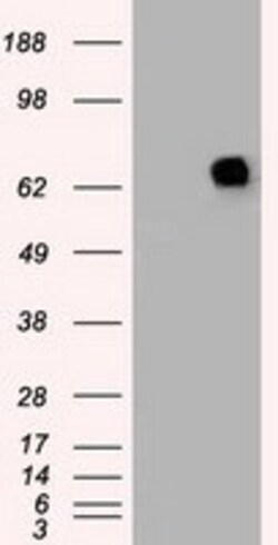 OriGene Melanoma gp100 (PMEL) Mouse Monoclonal Antibody [Clone ID: OTI8A4],