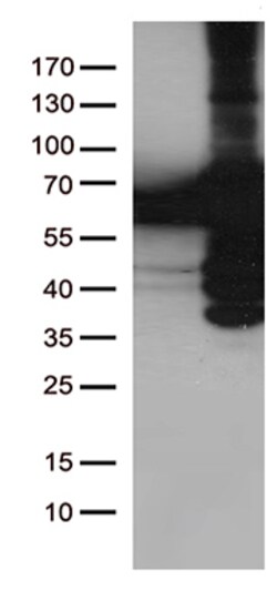 OriGene PLK1 Mouse Monoclonal Antibody [Clone ID: OTI6C6], Quantity: Each