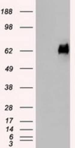 OriGene Melanoma gp100 (PMEL) Mouse Monoclonal Antibody [Clone ID: OTI9G3],