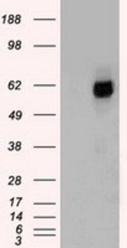 OriGene Chk2 (CHEK2) Mouse Monoclonal Antibody [Clone ID: OTI8D11], Quantity: