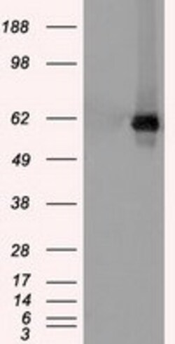 OriGene Chk2 (CHEK2) Mouse Monoclonal Antibody [Clone ID: OTI10G7], Quantity: