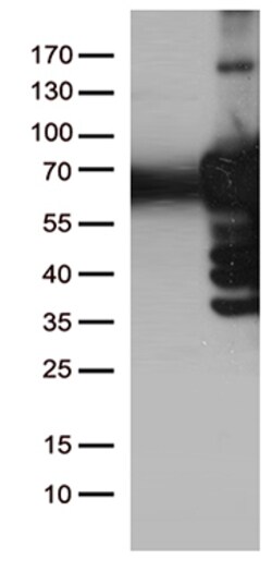 OriGene PLK1 Mouse Monoclonal Antibody [Clone ID: OTI1D4], Quantity: Each
