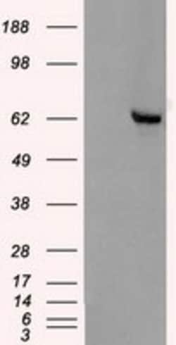 OriGene Chk2 (CHEK2) Mouse Monoclonal Antibody [Clone ID: OTI4C10], Quantity: