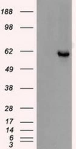 OriGene Chk2 (CHEK2) Mouse Monoclonal Antibody [Clone ID: OTI2H5], Quantity: