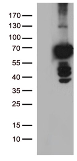 OriGene PLK1 Mouse Monoclonal Antibody [Clone ID: OTI3F12], Quantity: Each