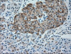 OriGene alpha 1 Antitrypsin (SERPINA1) Mouse Monoclonal Antibody [Clone