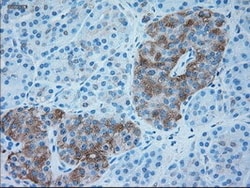 OriGene alpha 1 Antitrypsin (SERPINA1) Mouse Monoclonal Antibody [Clone