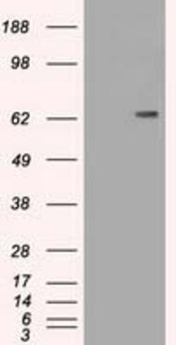 OriGene CD19 Mouse Monoclonal Antibody [Clone ID: OTI5F3], Quantity: Each