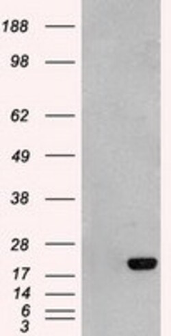OriGene Adenylate Kinase 1 (AK1) Mouse Monoclonal Antibody [Clone ID: OTI5G8],