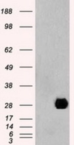 OriGene Neurogenin 1 (NEUROG1) Mouse Monoclonal Antibody [Clone ID: OTI5A10],