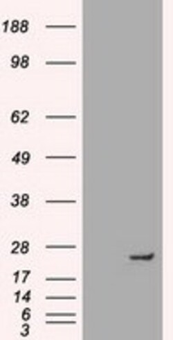 OriGene Neurogenin 1 (NEUROG1) Mouse Monoclonal Antibody [Clone ID: OTI10B10],