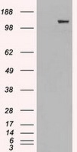 OriGene L1CAM Mouse Monoclonal Antibody [Clone ID: OTI1H3], Quantity: Each