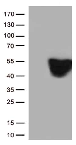 OriGene GFAP Mouse Monoclonal Antibody [Clone ID: OTI1B3], Quantity: Each