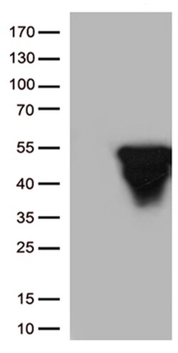 OriGene GFAP Mouse Monoclonal Antibody [Clone ID: OTI5B1], Quantity: Each