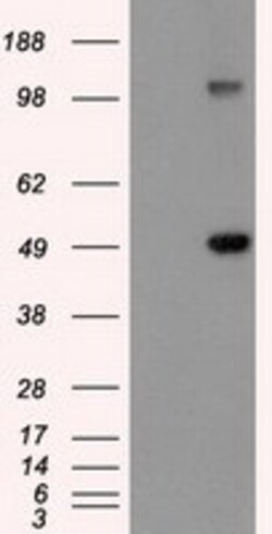 OriGene GFAP Mouse Monoclonal Antibody [Clone ID: OTI4G8], Quantity: Each