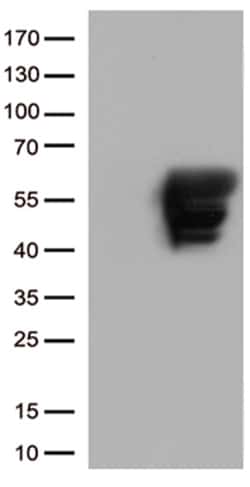 OriGene GFAP Mouse Monoclonal Antibody [Clone ID: OTI4C10], Quantity: Each