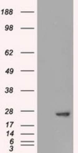 OriGene Adenylate Kinase 1 (AK1) Mouse Monoclonal Antibody [Clone ID: OTI19G4],
