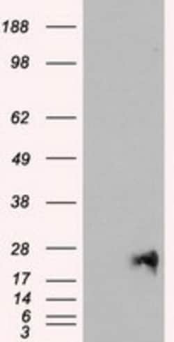 OriGene Neurogenin 1 (NEUROG1) Mouse Monoclonal Antibody [Clone ID: OTI6C9],