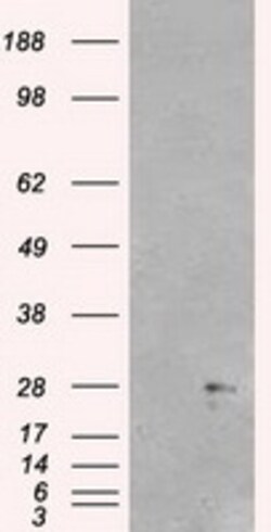 OriGene Neurogenin 1 (NEUROG1) Mouse Monoclonal Antibody [Clone ID: OTI5H10],